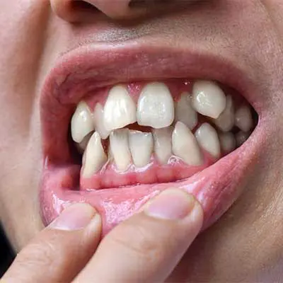Space for orthodontic care
